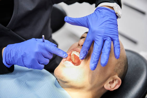 Best Cracked Tooth Emergency Dentist  in Ontario, CA